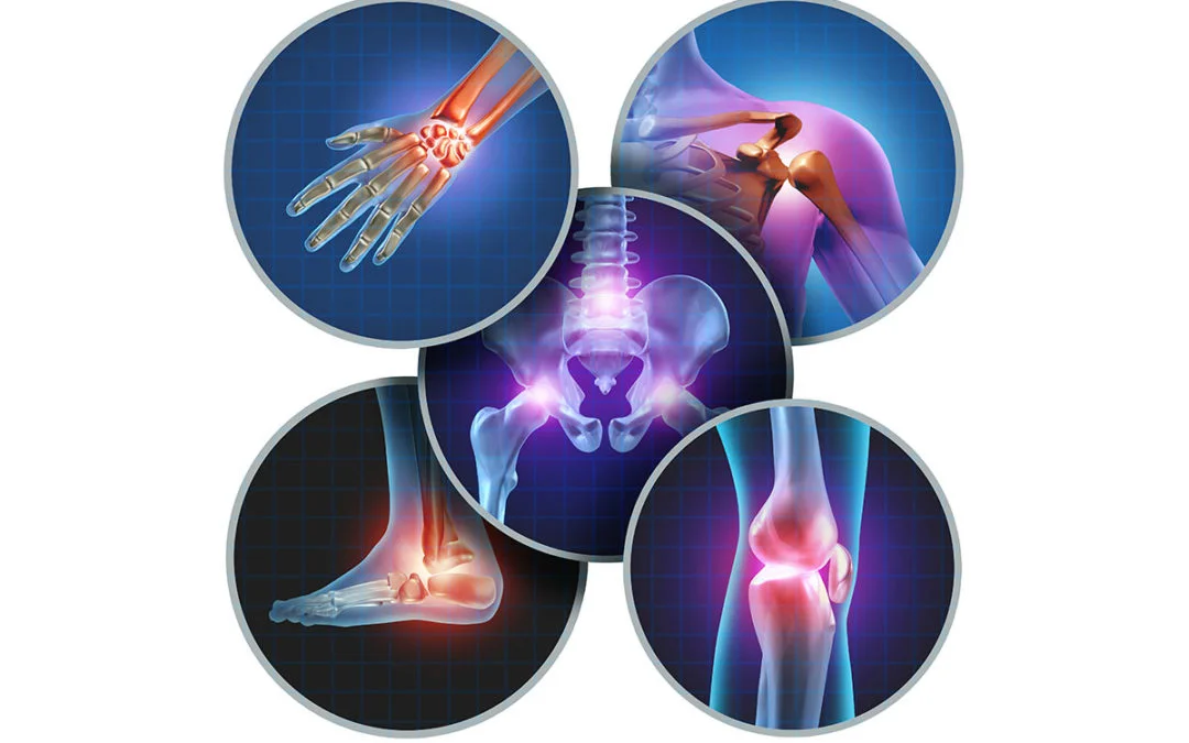 Vitamins an arthritis profile 